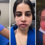 Urfi Javed removed lip fillers after 9 years, her lips were in bad shape, fans were shocked to see the video